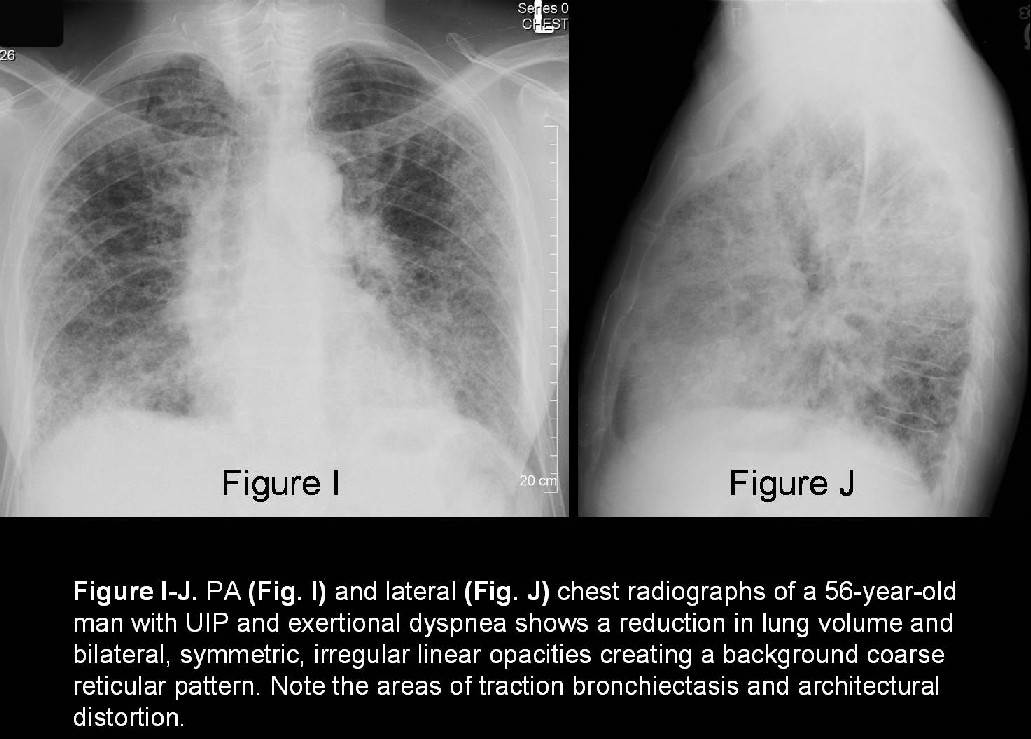 Radiograph 5 from archived case 27