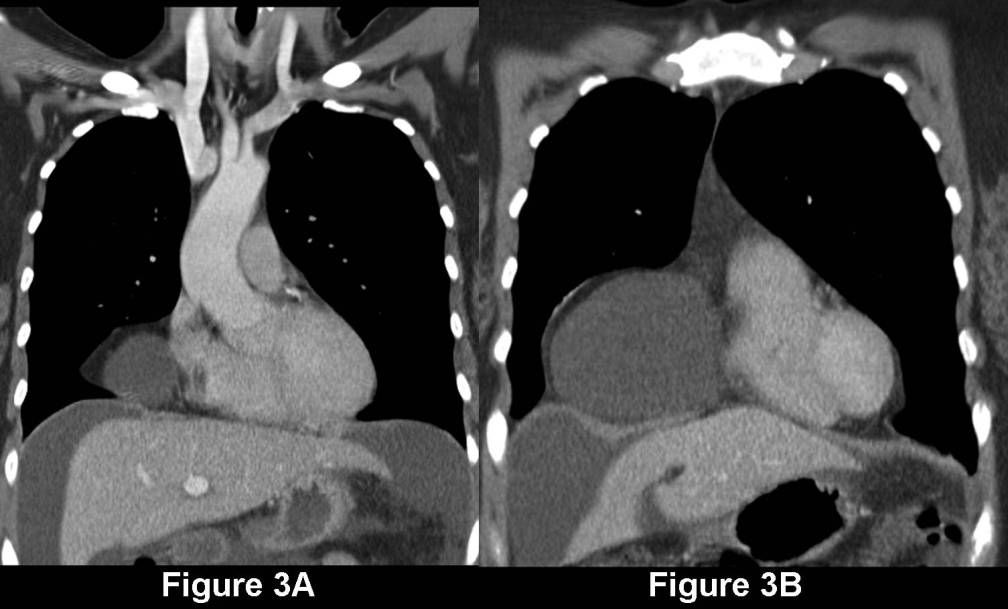 Radiograph 5 from archived case 67