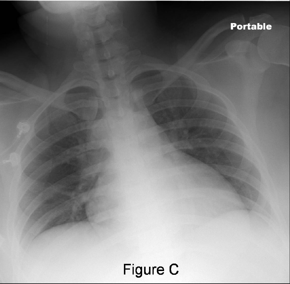 Radiograph 4 from archived case 39