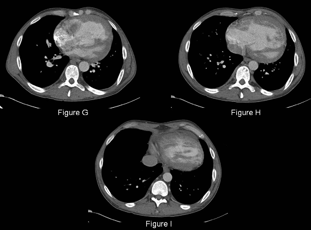 Radiograph 3 from archived case 40