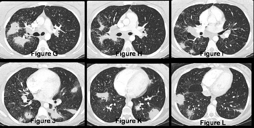 Radiograph 5 from archived case 23