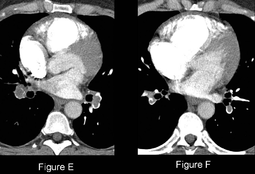 Radiograph 3 from archived case 41