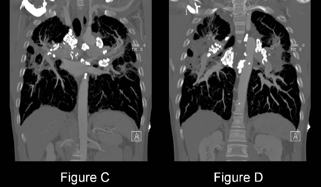 Radiograph 5 from archived case 21