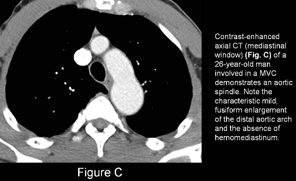 Radiograph 4 from archived case 17