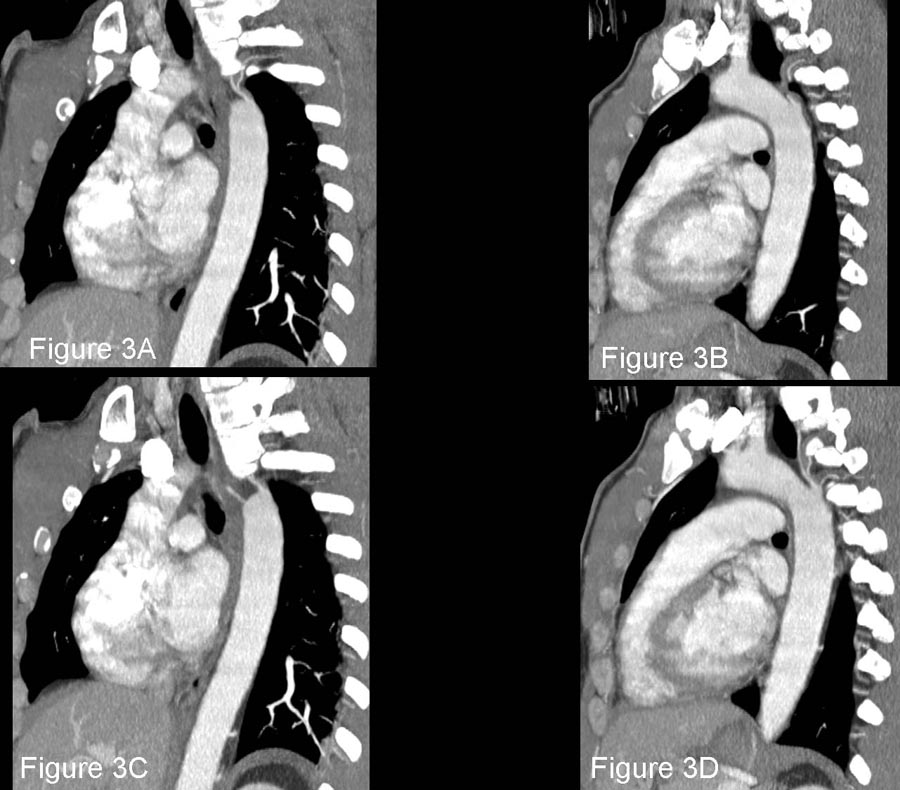 Radiograph 3 from archived case 66