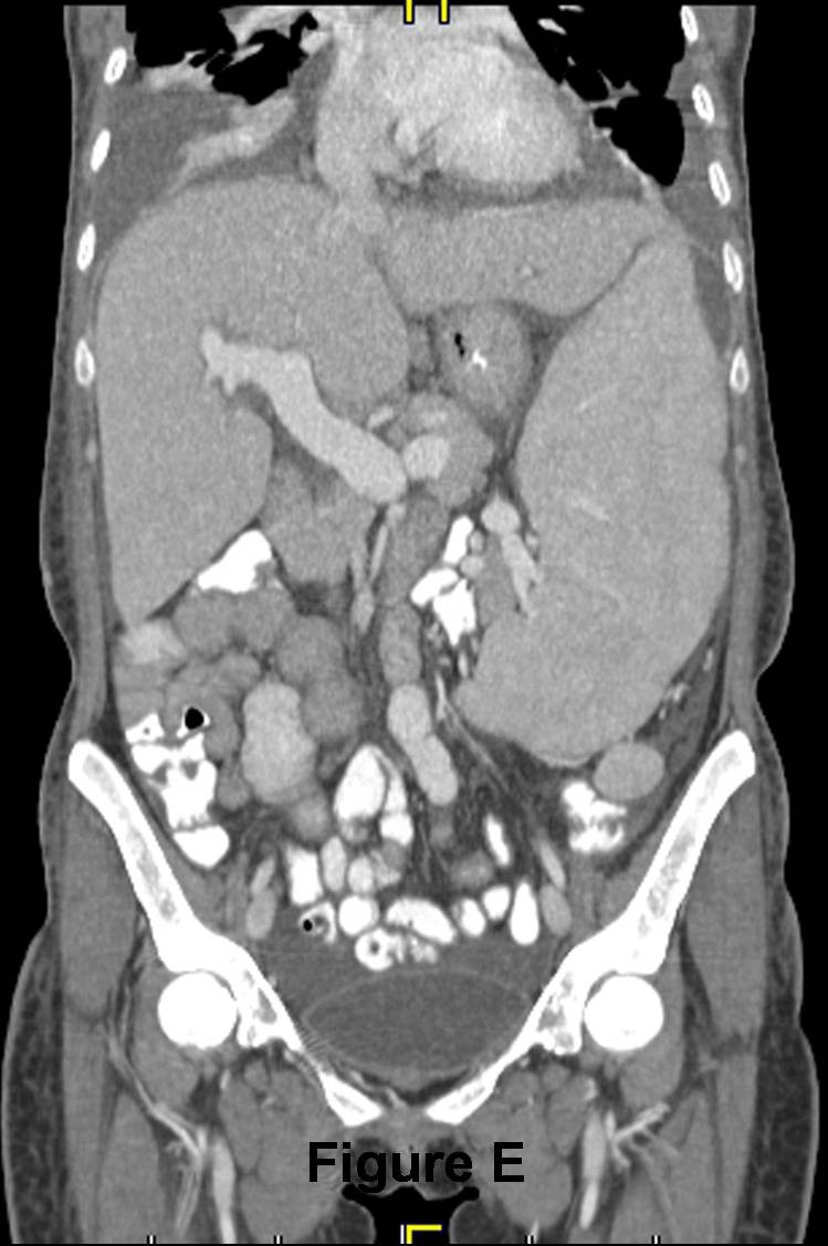 Radiograph 5 from archived case 32
