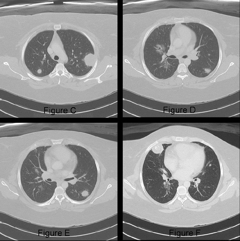 Radiograph 3 from archived case 33