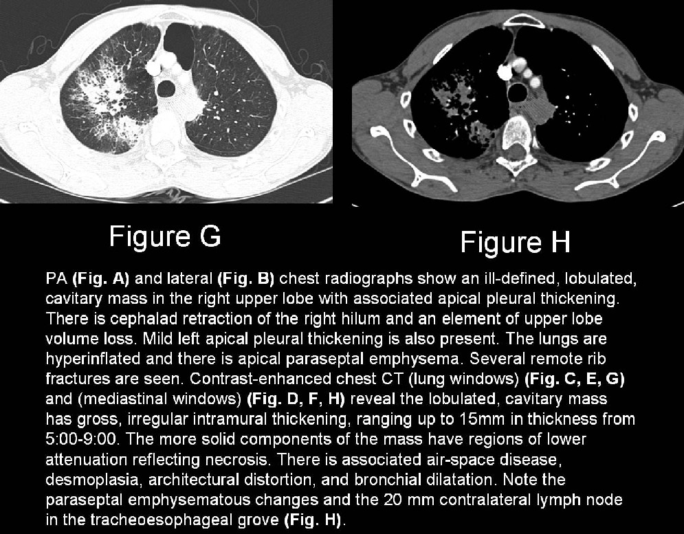 Radiograph 4 from archived case 16