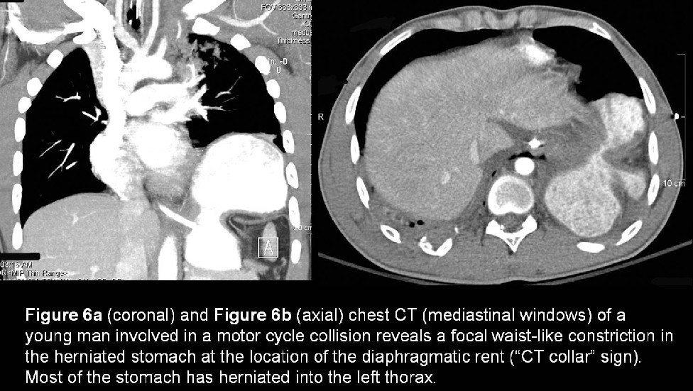 Radiograph 4 from archived case 8