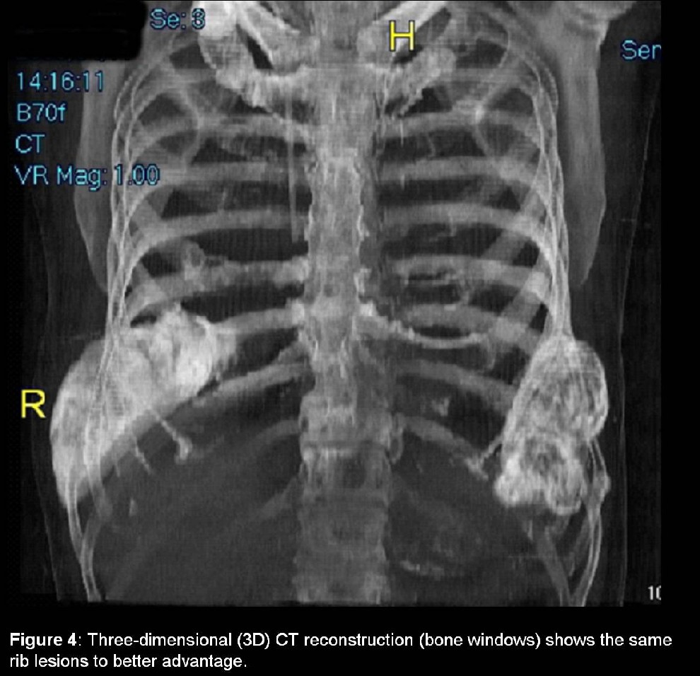Radiograph 5 from archived case 9