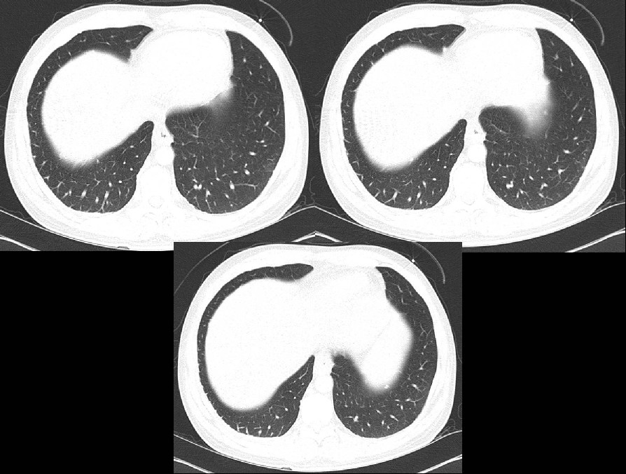 Radiograph 3 from archived case 4