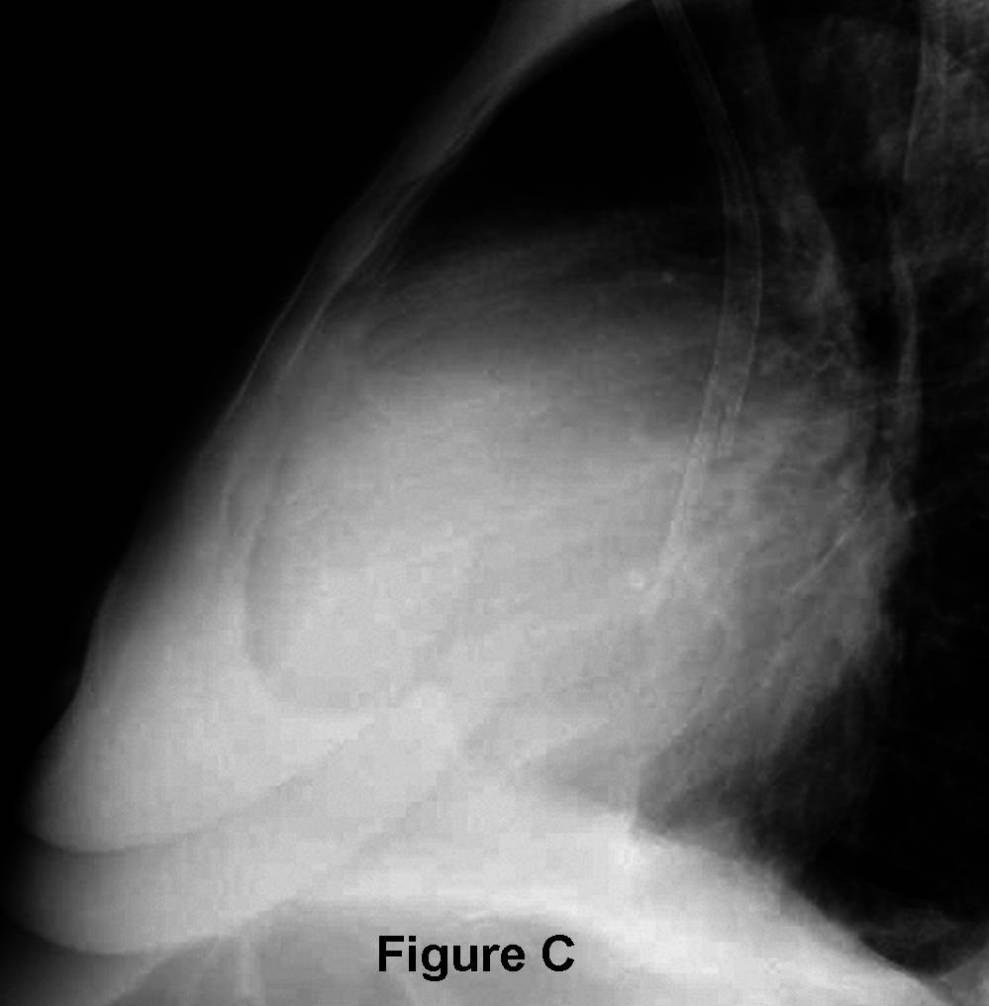 Radiograph 6 from archived case 52