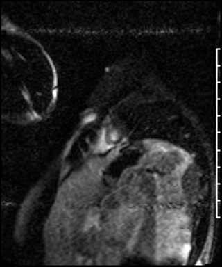 Radiograph 4 from archived case 73