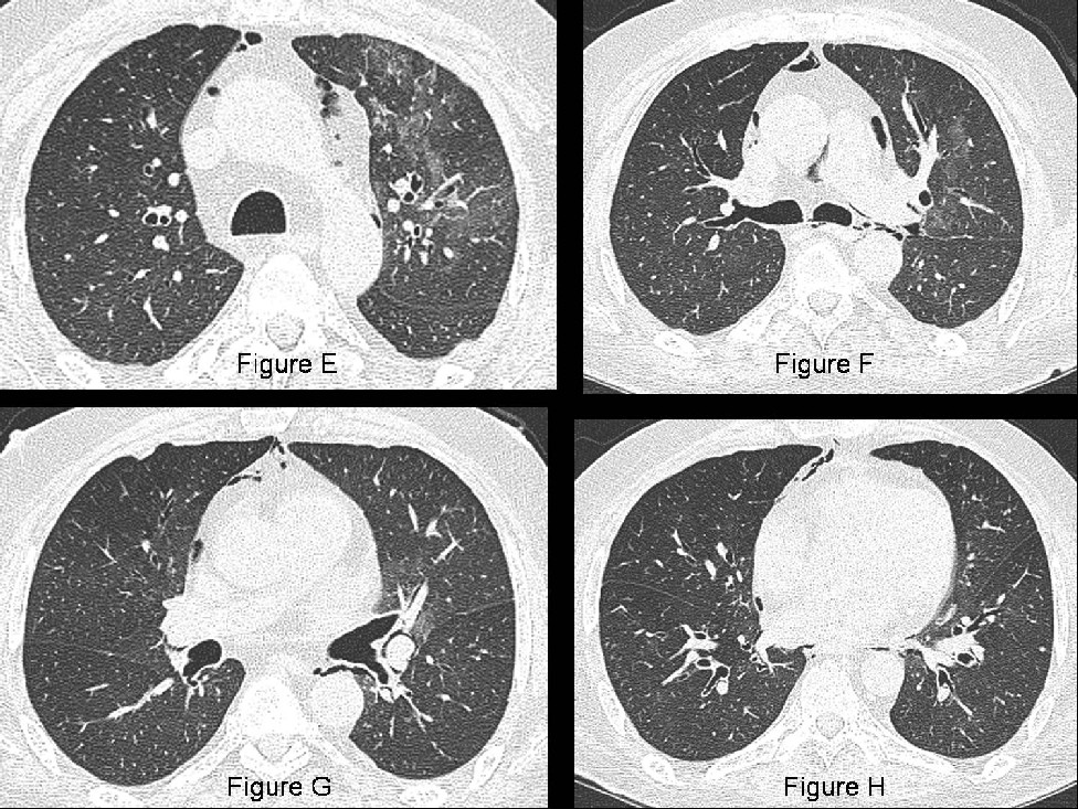 Radiograph 6 from archived case 37