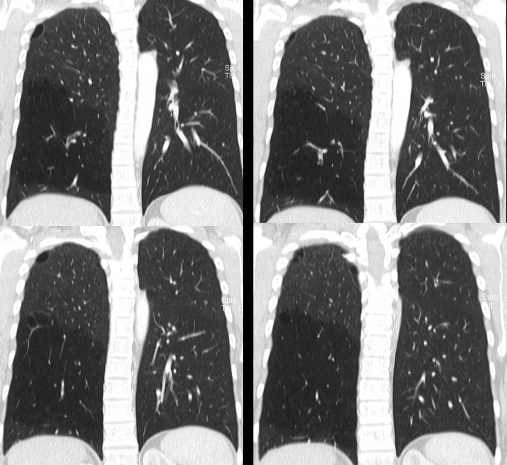 Radiograph 4 from archived case 54