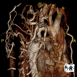 Radiograph 4 from archived case 57
