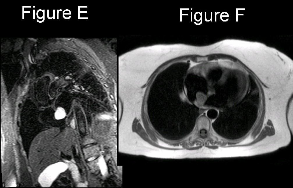 Radiograph 9 from archived case 20