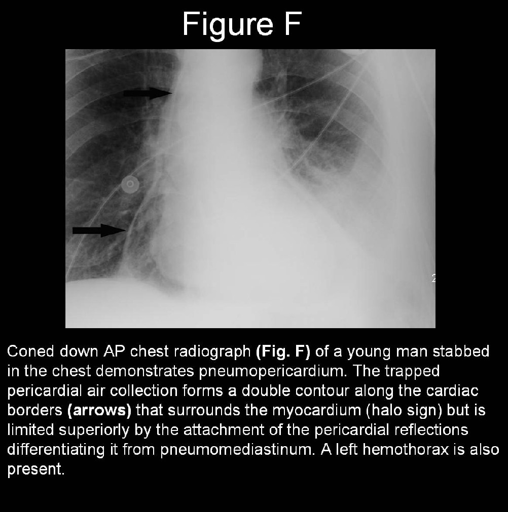 Radiograph 5 from archived case 19