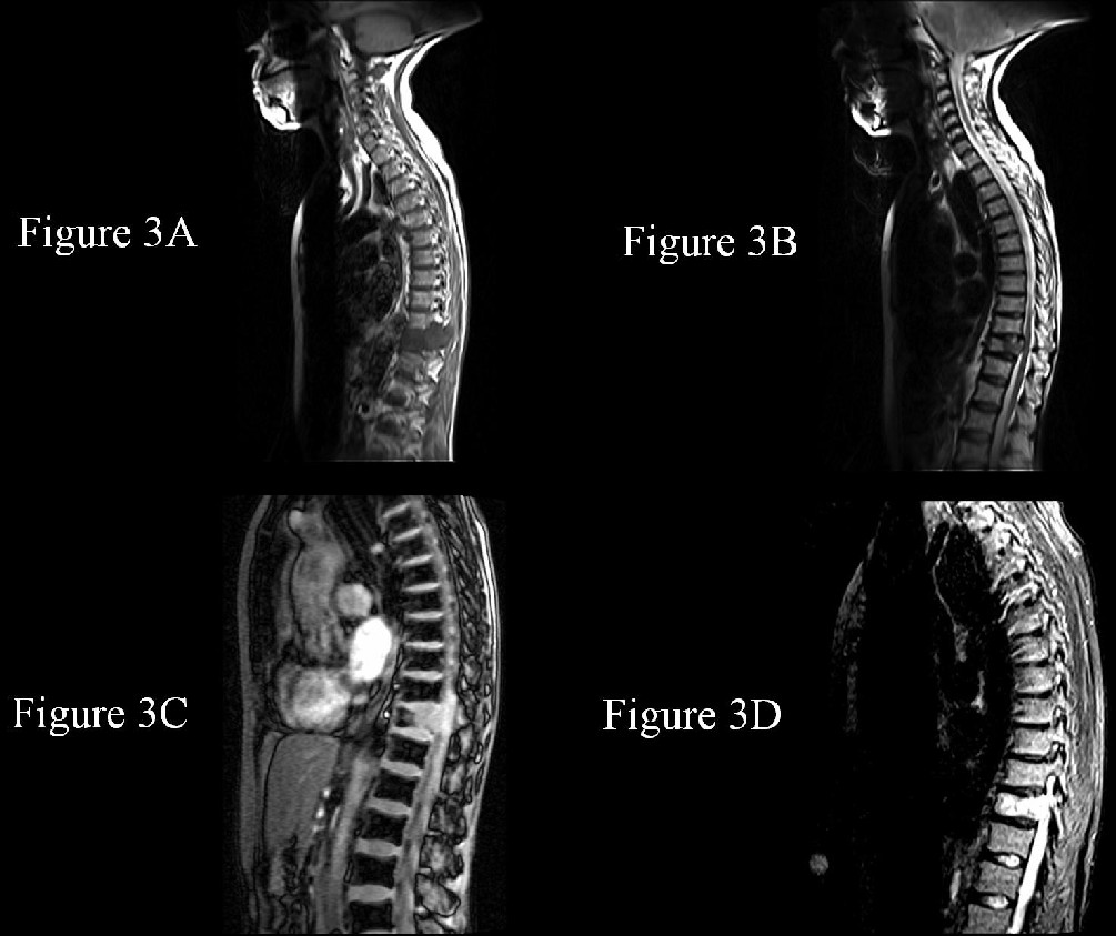 Radiograph 6 from archived case 11