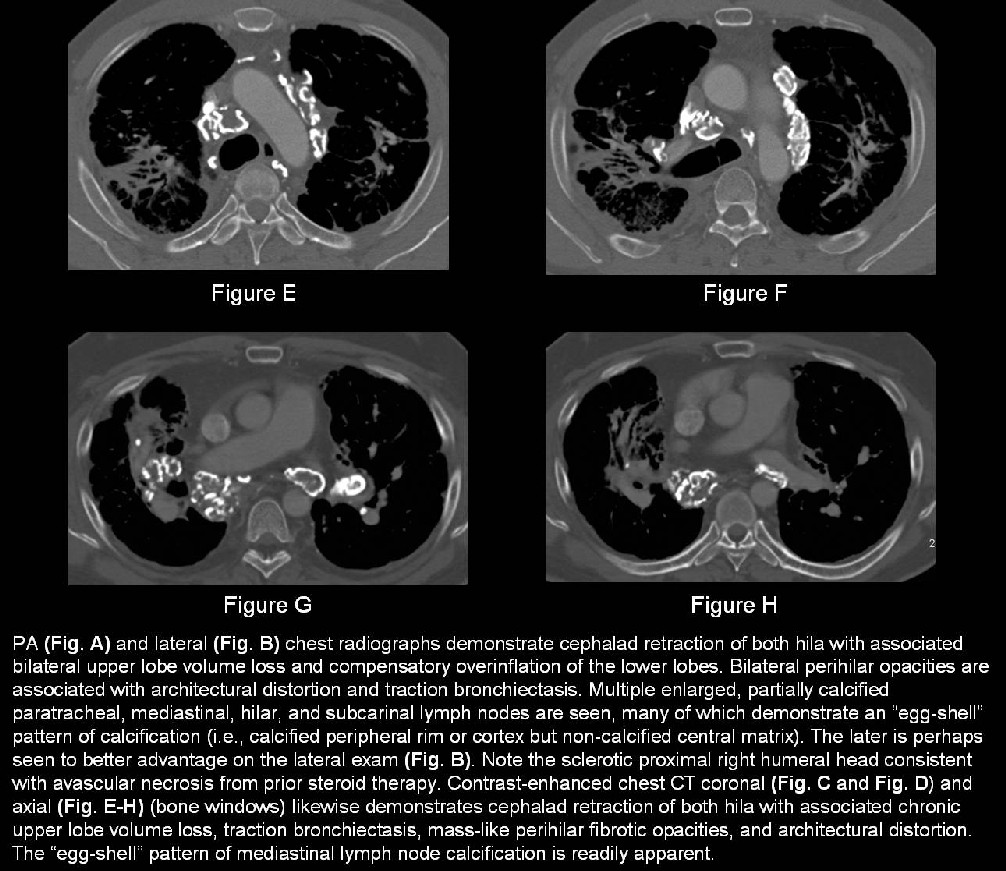 Radiograph 6 from archived case 21