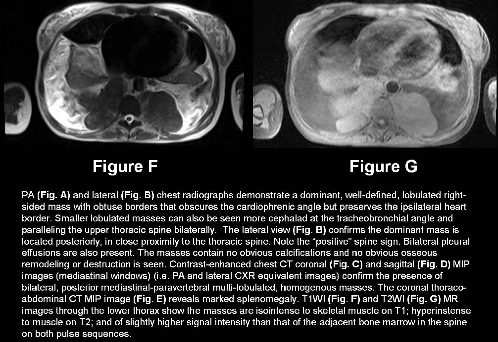 Radiograph 6 from archived case 32