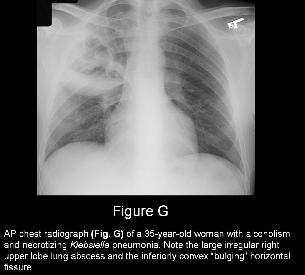 Radiograph 5 from archived case 13