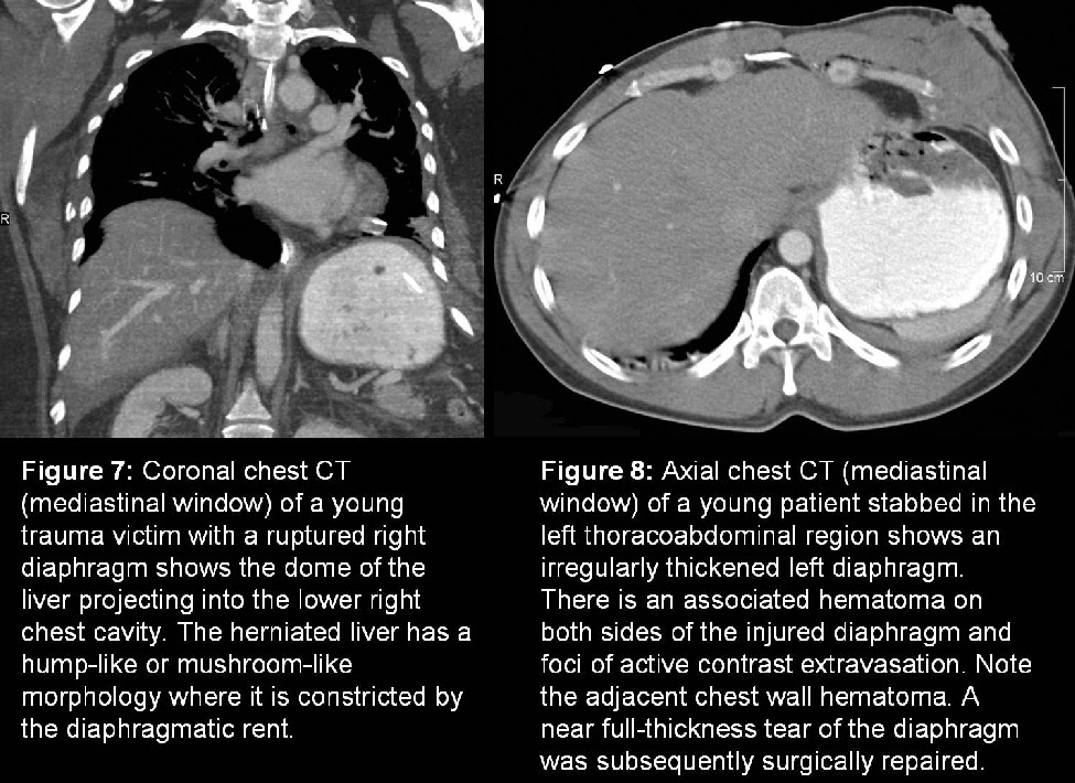 Radiograph 5 from archived case 8