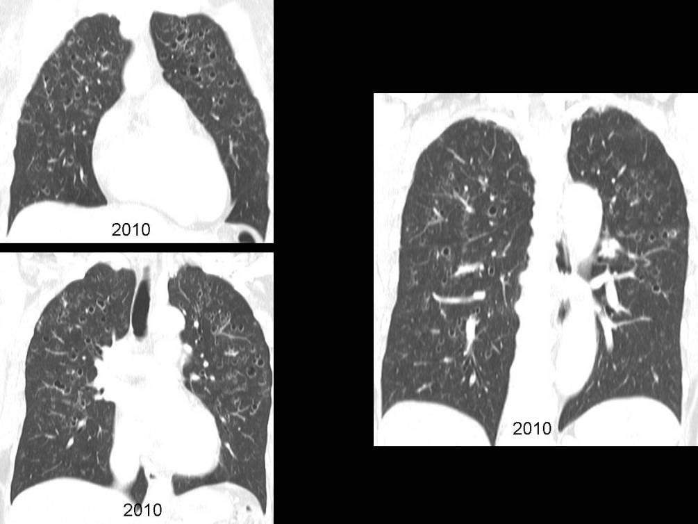 Radiograph 4 from archived case 49