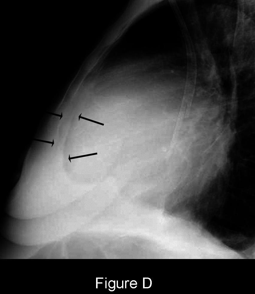 Radiograph 7 from archived case 52