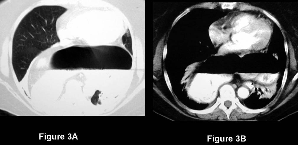 Radiograph 7 from archived case 76