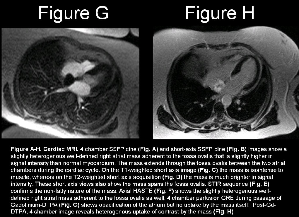 Radiograph 10 from archived case 20