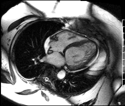 Radiograph 5 from archived case 42