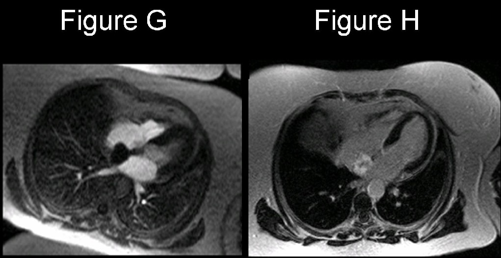 Radiograph 5 from archived case 20