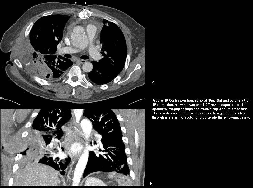 Radiograph 7 from archived case 5