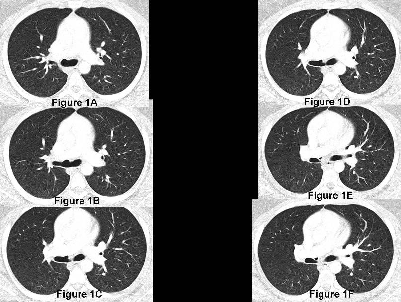 Radiograph 1 from archived case 79